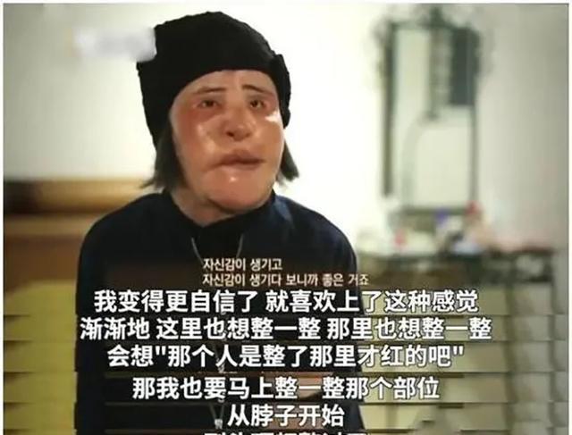 整容上瘾韩慧景：把脸整成电风扇自行注射食用油代价惨痛(图7)