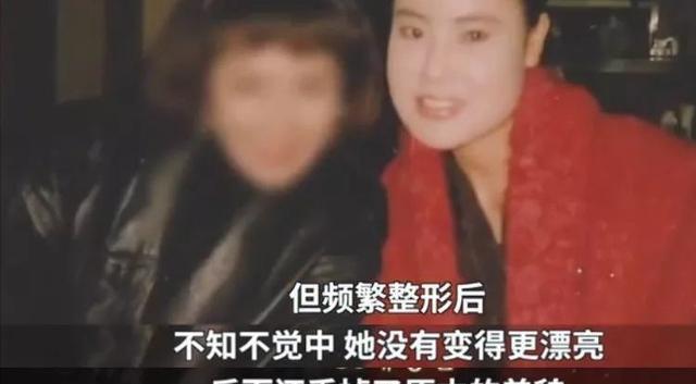 整容上瘾韩慧景：把脸整成电风扇自行注射食用油代价惨痛(图9)