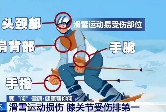 运动网红滑雪摔骨折打了24颗钉子笑嘻嘻：明年再战(图3)